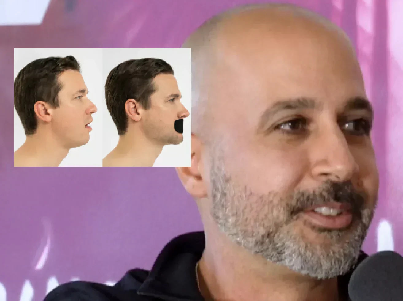 Is Mouth Taping Actually Safe During Sleep? - Dr. Alfi Explains