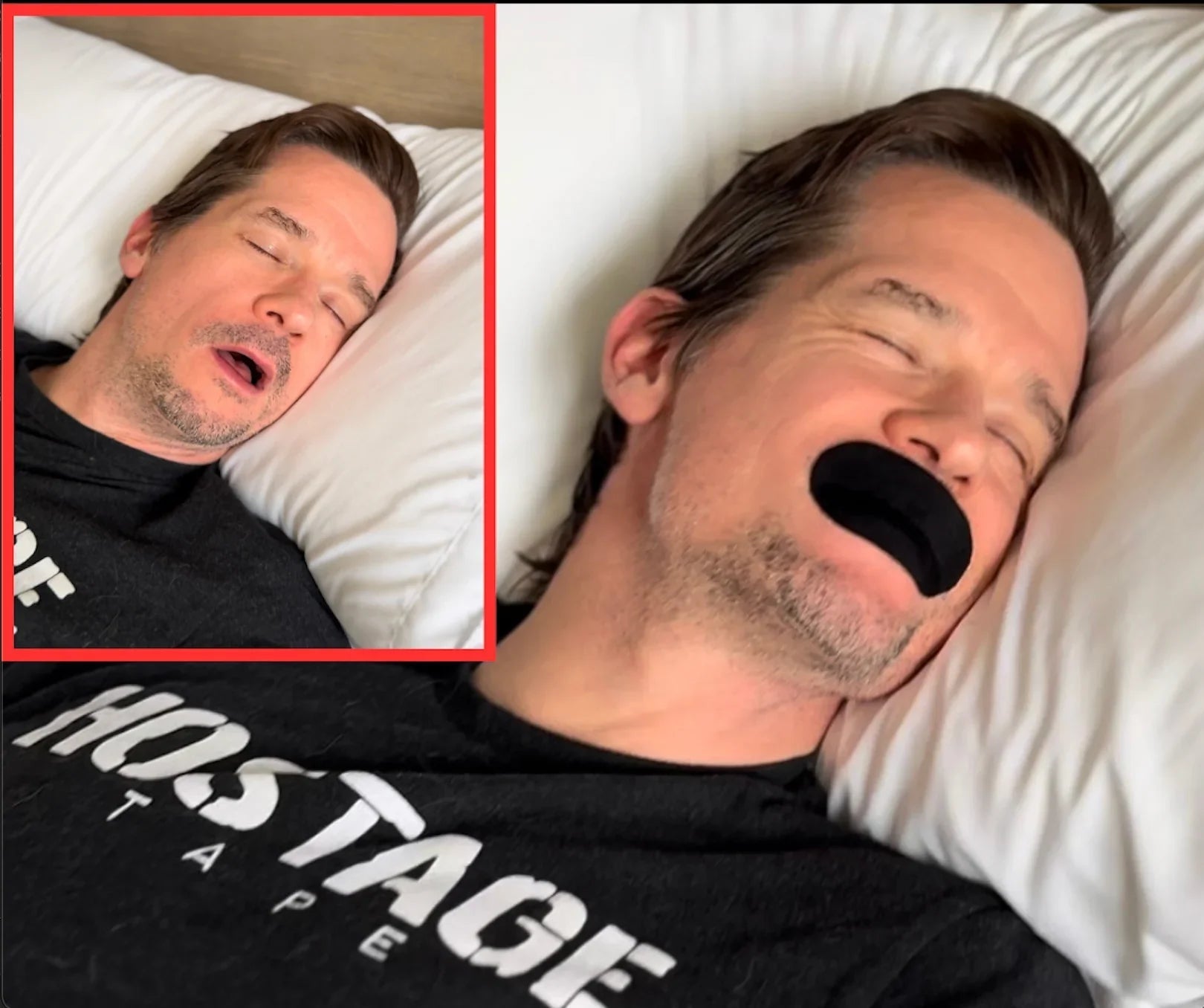 Man sleeping with mouth open and then with Hostage Tape applied, showing improved mouth closure