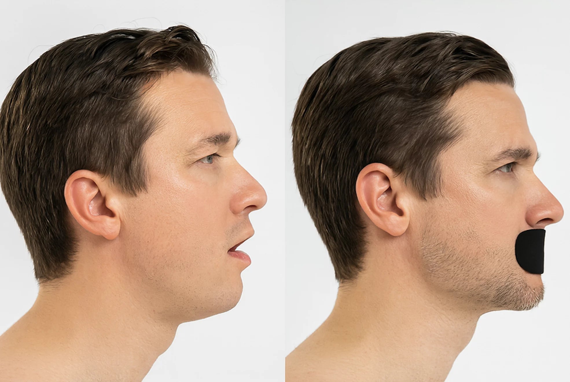 Hostage Tape before and after comparison showing improved mouth posture and closed-mouth breathing