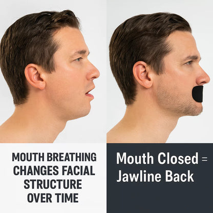 Hostage Tape mouth closed vs mouth open side profile showing jawline improvement